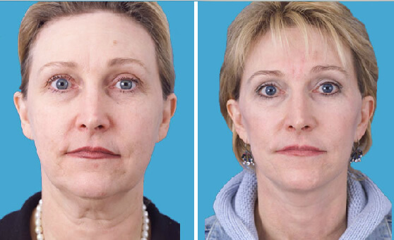 , Learn About our Various Surgical and Minimally Invasive Cosmetic Procedures